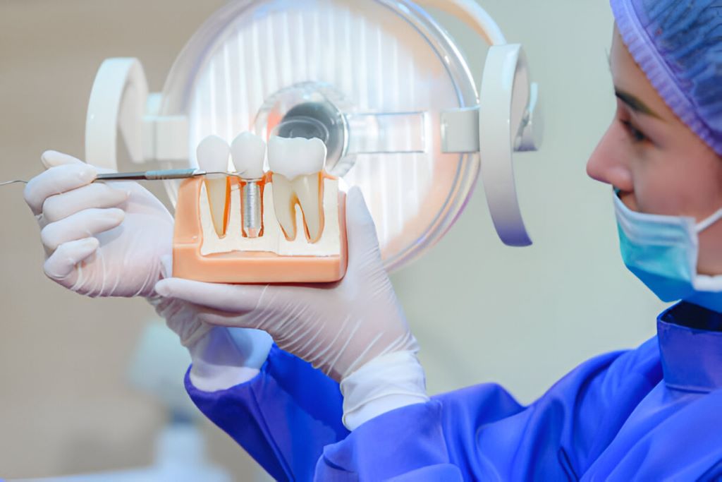 dental implants near you