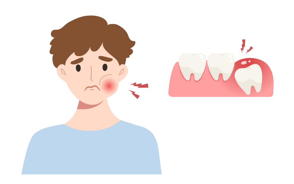 wisdom tooth extractions markham